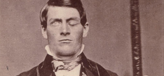 Il terribile incidente di Phineas P. Gage Phineas P. Gage